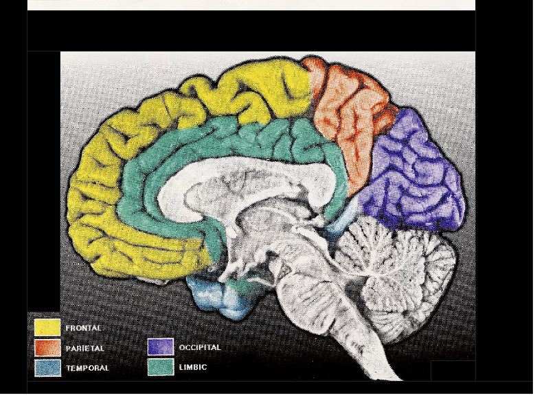 brain image 1