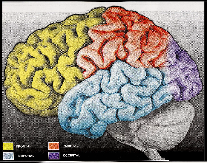 brain image 2